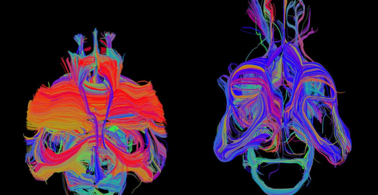 functional neuroimaging